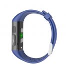 MF12 Magyar Nyelvű Vércukorszintmérő Okosóra